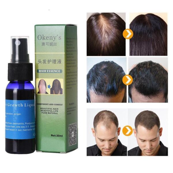 Sunburst Hair Growth Products for women&men anti hair loss products Alopecia Baldness beard oil growth Hair growth spray - Image 3