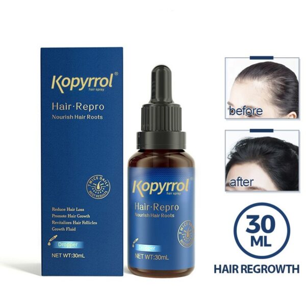 Hair-care Lotion For Men And Women's Hairline - Image 3