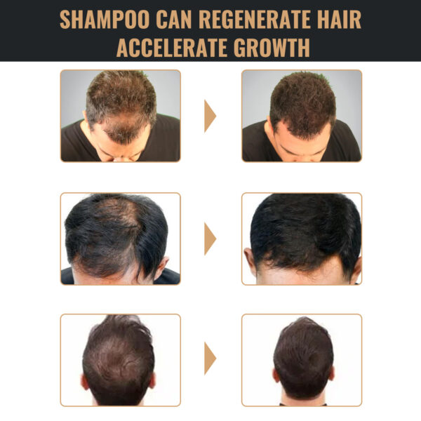 Root Activator Shampoo, Natural Hair Regrowth Shampoos, Unisex Hair Thickening Shampoo, Gently Shampoo For Men & Women, Nourishing Long Lasting Hair Care For Darker & Thicker Hair - Image 9