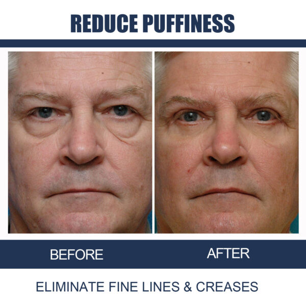 Men's Anti-aging Eye Cream - Image 7