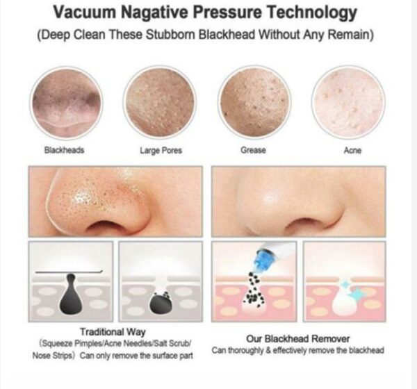 Facial Pore Cleaner - Image 4