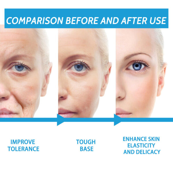 Fading Wrinkle Anti-wrinkle Anti-aging Moisturizing Cream - Image 2