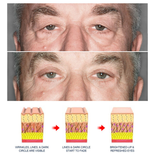 Men's Anti-aging Eye Cream - Image 6