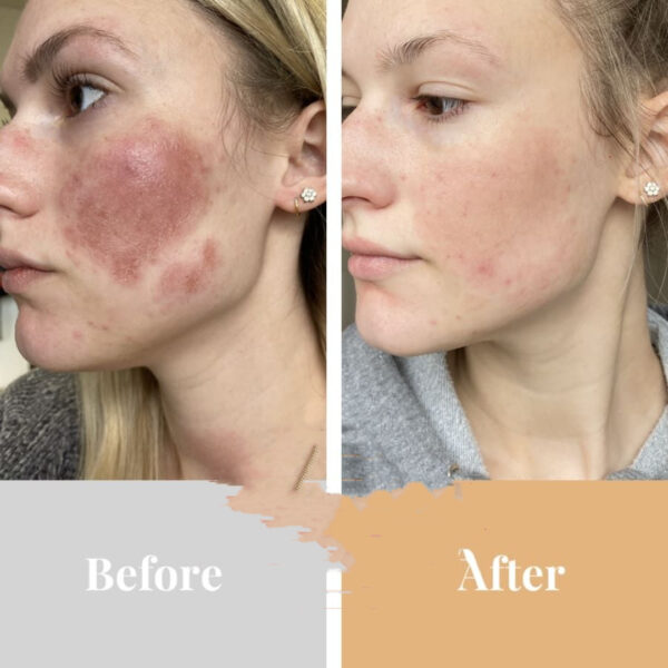 Collagen Anti Aging Beauty Instrument - Image 5
